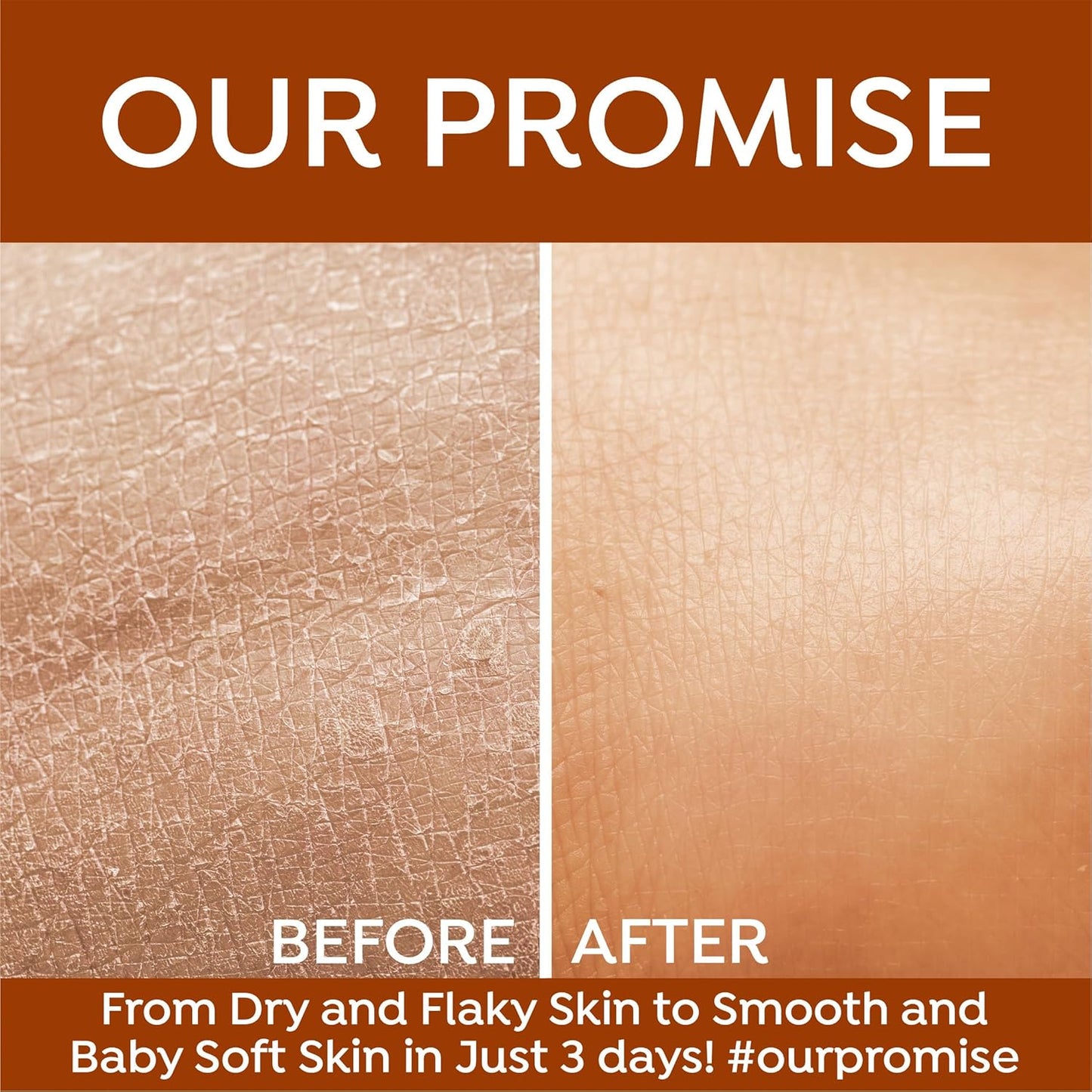 Honey & Almond Moisturiser 1000ml